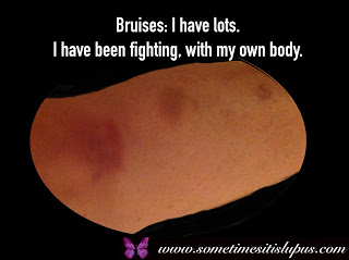 text: bruises: I have lots. I have been fighting, with my own body.